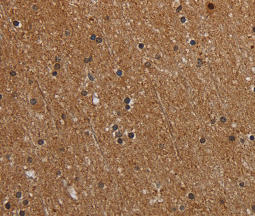 Immunohistochemistry of paraffin-embedded Human brain  using MT-ND1 Polyclonal Antibody at dilution of 1:50