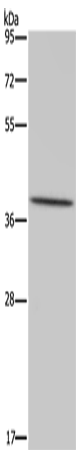 Western Blot analysis of Hela cell using MT-ND1 Polyclonal Antibody at dilution of 1:450