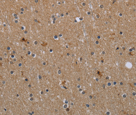 Immunohistochemistry of paraffin-embedded Human brain  tissue using MYO7A Polyclonal Antibody at dilution 1:30