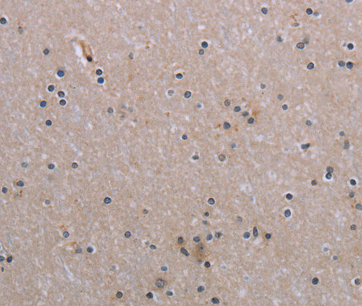 Immunohistochemistry of paraffin-embedded Human brain  tissue using NAIP Polyclonal Antibody at dilution 1:30