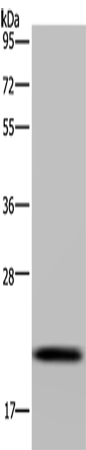 Western Blot analysis of Raji cell using NDUFAF4 Polyclonal Antibody at dilution of 1:300