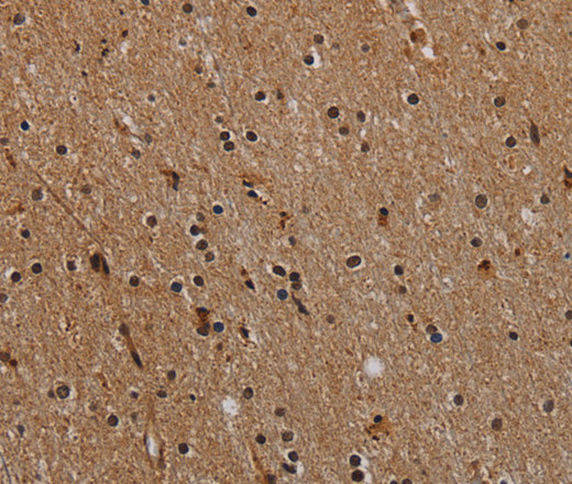 Immunohistochemistry of paraffin-embedded Human brain  tissue using NLRP9 Polyclonal Antibody at dilution 1:40