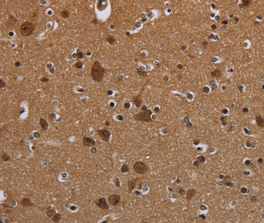 Immunohistochemistry of paraffin-embedded Mouse brain using MYCN Polyclonal Antibody at dilution 1:35