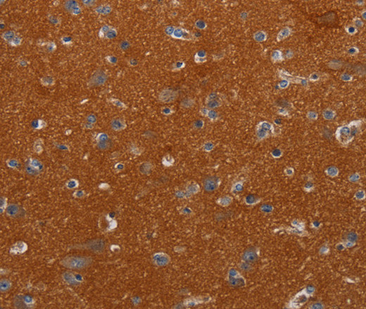 Immunohistochemistry of paraffin-embedded Human brain tissue using NOX3 Polyclonal Antibody at dilution 1:40