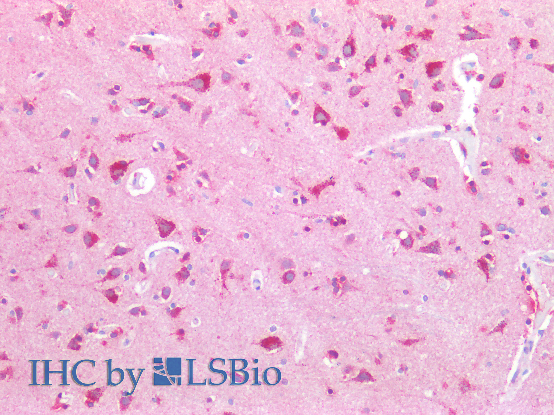 Immunohistochemistry of paraffin-embedded Human adrenal tissue using NPTX1 Polyclonal Antibody at dilution of 1:100.