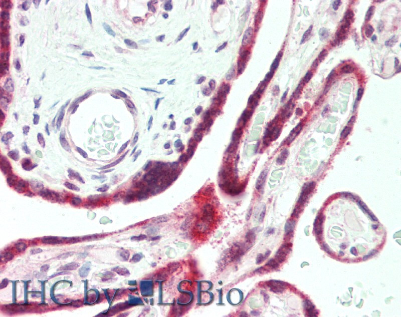 Immunohistochemistry of paraffin-embedded Human Placenta using PAPPA Polyclonal Antibody at dilution of 1:100.