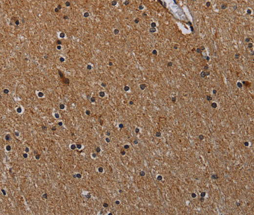 Immunohistochemistry of paraffin-embedded Human brain  using IVL Polyclonal Antibody at dilution of 1:50