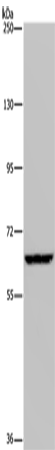 Western Blot analysis of Hela cell using IVL Polyclonal Antibody at dilution of 1:200