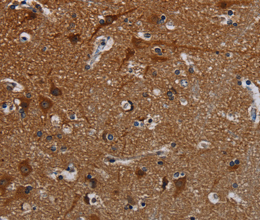 Immunohistochemistry of paraffin-embedded Human brain tissue using PCDHB15 Polyclonal Antibody at dilution 1:50