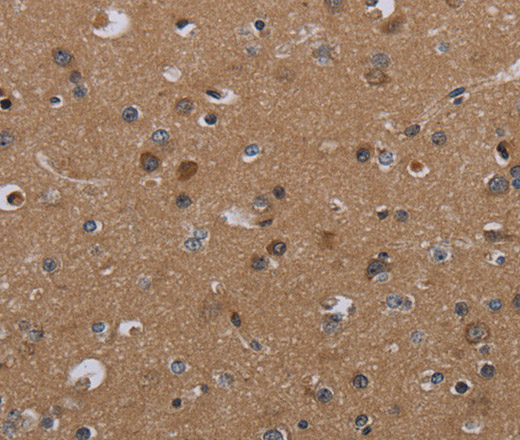 Immunohistochemistry of paraffin-embedded Human brain  tissue using PDGFC Polyclonal Antibody at dilution 1:40