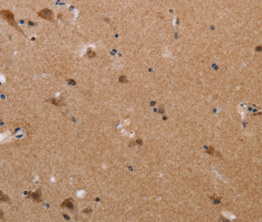 Immunohistochemistry of paraffin-embedded Human brain  tissue using PLXNA4 Polyclonal Antibody at dilution 1:50