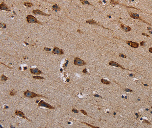 Immunohistochemistry of paraffin-embedded Human brain tissue using PLXNB1 Polyclonal Antibody at dilution 1:40