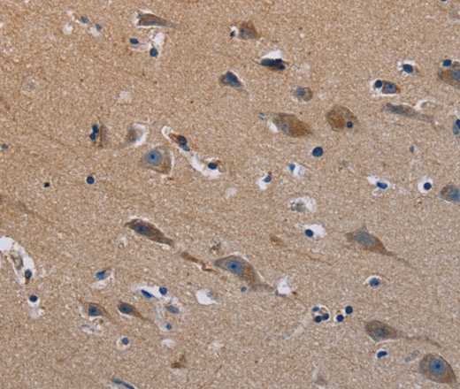 Immunohistochemistry of paraffin-embedded Human brain tissue using PLXND1 Polyclonal Antibody at dilution 1:40