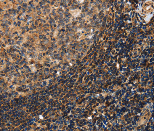 Immunohistochemistry of paraffin-embedded Human tonsil using PON1 Polyclonal Antibody at dilution of 1:40