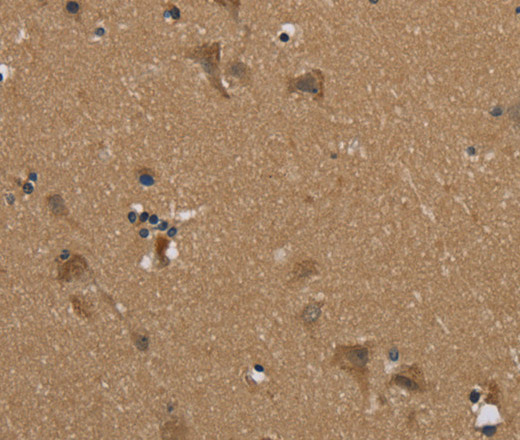 Immunohistochemistry of paraffin-embedded Human brain  using PUS10 Polyclonal Antibody at dilution of 1:45