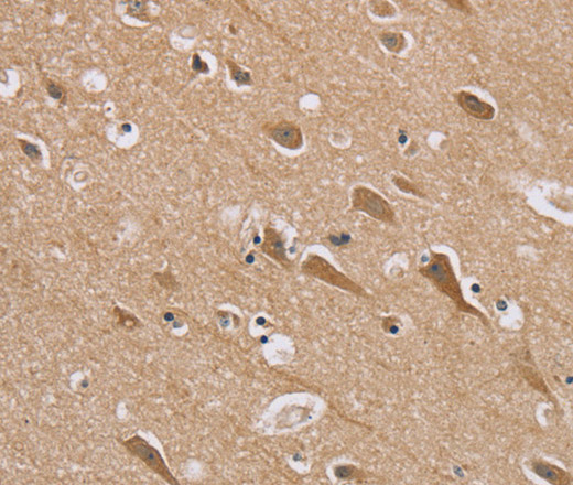 Immunohistochemistry of paraffin-embedded Human brain tissue using RAB6C Polyclonal Antibody at dilution 1:45