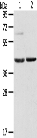 Western Blot analysis of Mouse brain and liver tissue using HIF1AN Polyclonal Antibody at dilution of 1:200