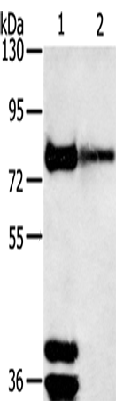 Western Blot analysis of Mouse brain and Human fetal brain tissue using TRIM3 Polyclonal Antibody at dilution of 1:200