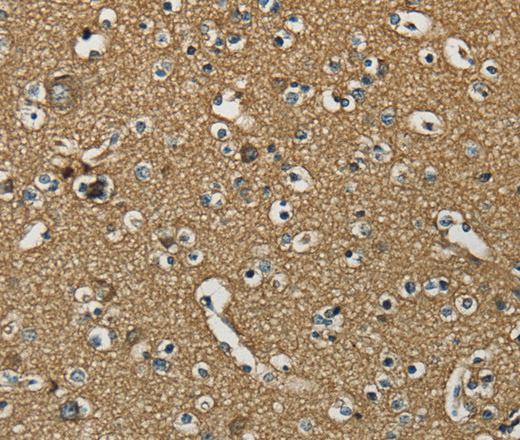 Immunohistochemistry of paraffin-embedded Human brain using NEMF Polyclonal Antibody at dilution of 1:30