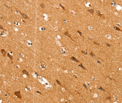 Immunohistochemistry of paraffin-embedded Human brain tissue using SLC25A12 Polyclonal Antibody at dilution 1:30