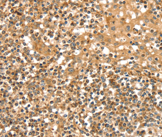 Immunohistochemistry of paraffin-embedded Human tonsil tissue using SLC8A3 Polyclonal Antibody at dilution 1:35