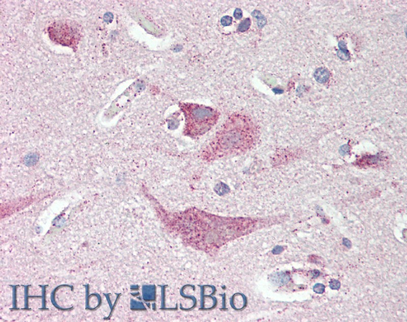 Immunohistochemistry of paraffin-embedded Brain Cortex tissue using SLC8A3 Polyclonal Antibody at dilution of 1:80 .