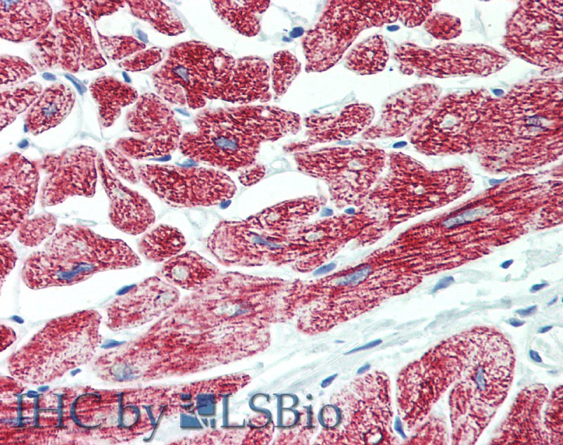 Immunohistochemistry of paraffin-embedded Heart tissue using ROR1 Polyclonal Antibody at dilution of 1:90 .