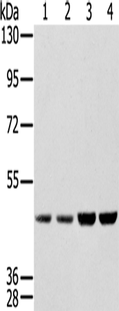 Western Blot analysis of Hela, Raji, 231 and K562 cell using SSB Polyclonal Antibody at dilution of 1:400