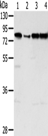 Western Blot analysis of Jurkat, hepg2, Raji and A431 cell using TAF15 Polyclonal Antibody at dilution of 1:450