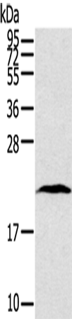 Western Blot analysis of Human lung cancer tissue using TAF10 Polyclonal Antibody at dilution of 1:400