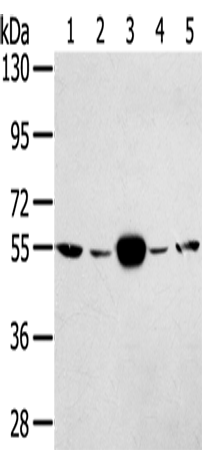 Western Blot analysis of Hela and K562 cell, Human fetal muscle tissue, A375 and hepg2 cell using TRIM35 Polyclonal Antibody at dilution of 1:400