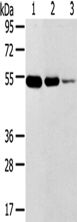 Western Blot analysis of Human thyroid and esophagus cancer, Human normal rectum tissue using TMPRSS11F Polyclonal Antibody at dilution of 1:500