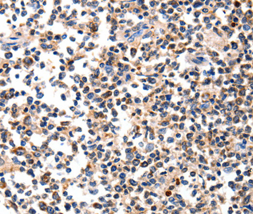 Immunohistochemistry of paraffin-embedded Human tonsil using AFP Polyclonal Antibody at dilution of 1:60