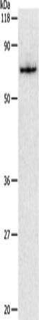 Western Blot analysis of Hela cell using PKM Polyclonal Antibody at dilution of 1:450