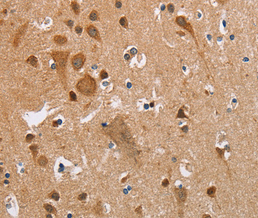 Immunohistochemistry of paraffin-embedded Human brain  using CK-13 Polyclonal Antibody at dilution of 1:35