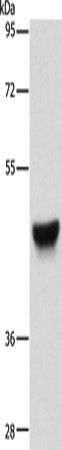 Western Blot analysis of Human esophagus cancer tissue using CK-13 Polyclonal Antibody at dilution of 1:500