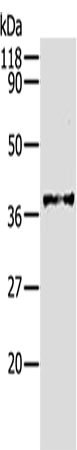 Western Blot analysis of Hela cell using AKR1B1 Polyclonal Antibody at dilution of 1:340