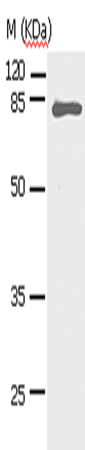 Western Blot analysis of Human fetal lung tissue using STAT5A Polyclonal Antibody at dilution of 1:450