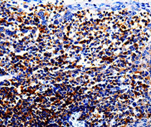 Immunohistochemistry of paraffin-embedded Human tosil tissue using IL10RA Polyclonal Antibody at dilution 1:60