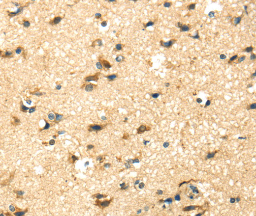 Immunohistochemistry of paraffin-embedded Human brain tissue using CK-17 Polyclonal Antibody at dilution 1:40