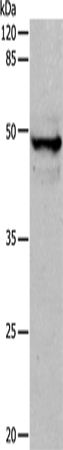 Western Blot analysis of Mouse thymus tissue using CK-15 Polyclonal Antibody at dilution of 1:400