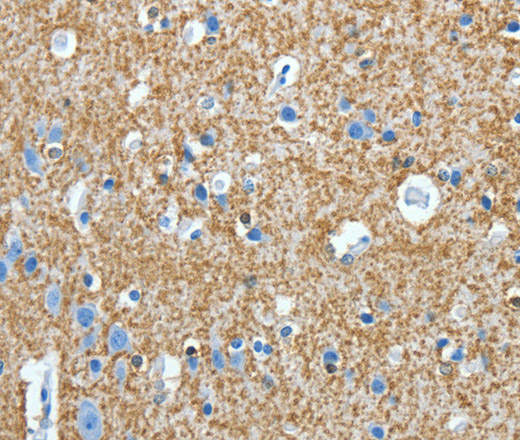 Immunohistochemistry of paraffin-embedded Human brain tissue using Amphiphysin II Polyclonal Antibody at dilution 1:30