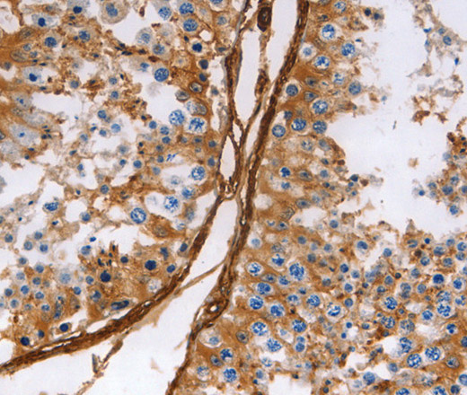 Immunohistochemistry of paraffin-embedded Human testis using Caldesmon Polyclonal Antibody at dilution of 1:40