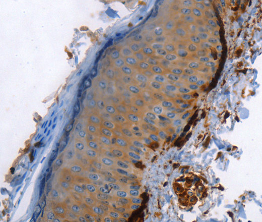 Immunohistochemistry of paraffin-embedded Human skin using Caldesmon Polyclonal Antibody at dilution of 1:40