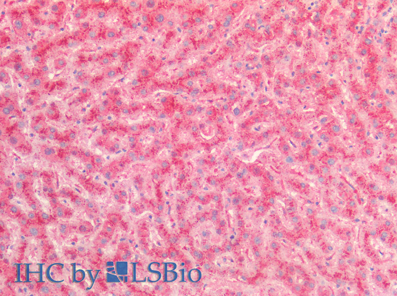 Immunohistochemistry of paraffin-embedded Human Liver using Cathepsin B Polyclonal Antibody at dilution of 1:100.