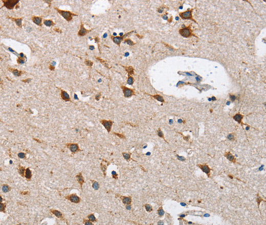 Immunohistochemistry of paraffin-embedded Human brain using Cathepsin L Polyclonal Antibody at dilution of 1:40