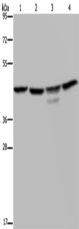 Western Blot analysis of K562 and 293T cell, Jurkat cell and Mouse brain tissue using CSNK2A1 Polyclonal Antibody at dilution of 1:300