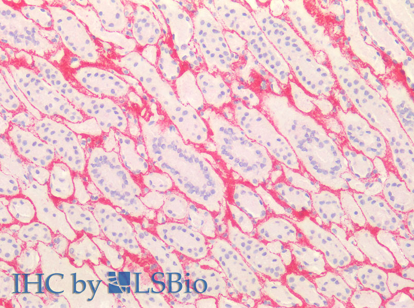 Immunohistochemistry of paraffin-embedded Human kidney, testis using COL3A1 Polyclonal Antibody at dilution of 1:100.