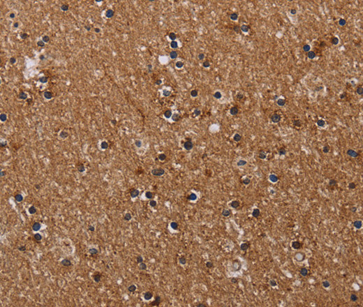 Immunohistochemistry of paraffin-embedded Human brain  tissue using CLDND1 Polyclonal Antibody at dilution 1:40