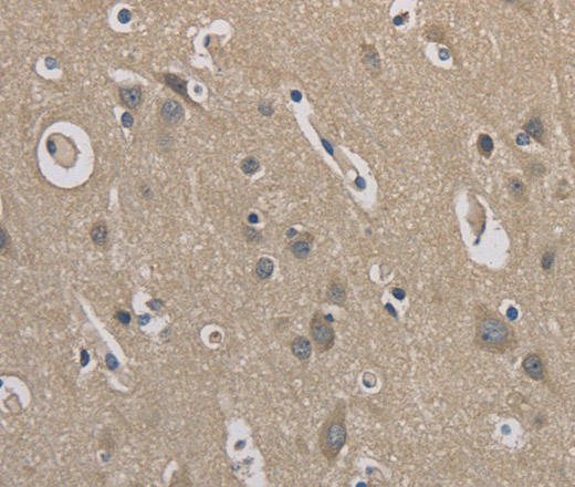 Immunohistochemistry of paraffin-embedded Human brain  using EMC8 Polyclonal Antibody at dilution of 1:30